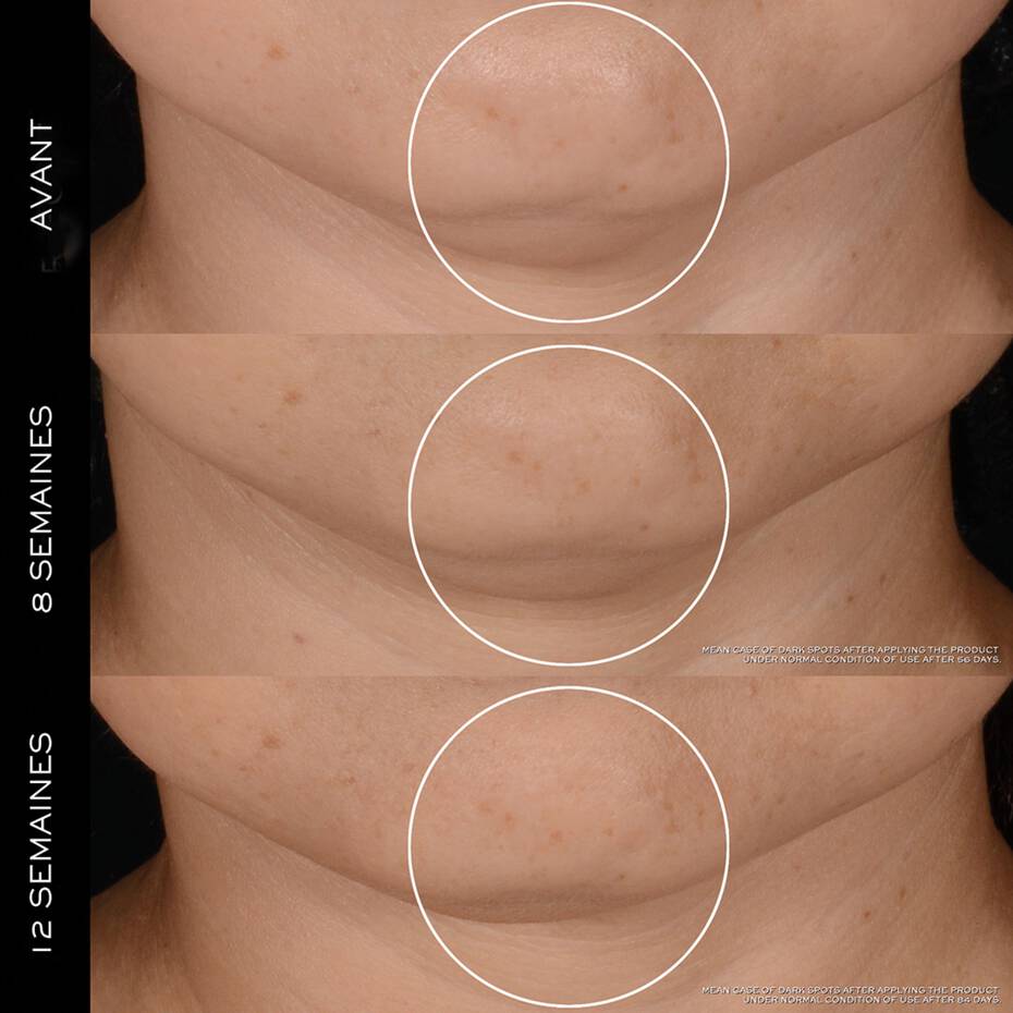 LANCÔME - CRÈME RÉNERGIE H.P.N. 300-PEPTIDE 50 ML
