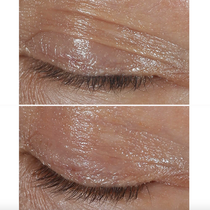 Clinique - Clinique Smart Clinical Repair - Crème Yeux Correction Rides