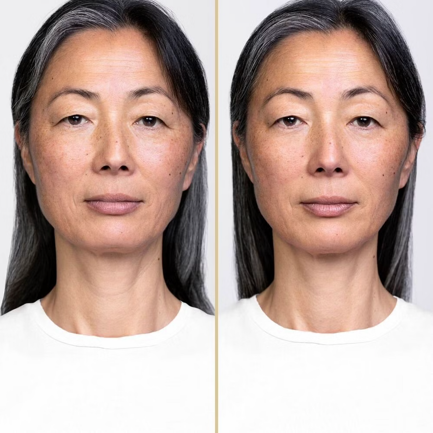 SHISEIDO - VITAL PERFECTION LIFTDEFINE RADIANCE NIGHT CONCENTRATE