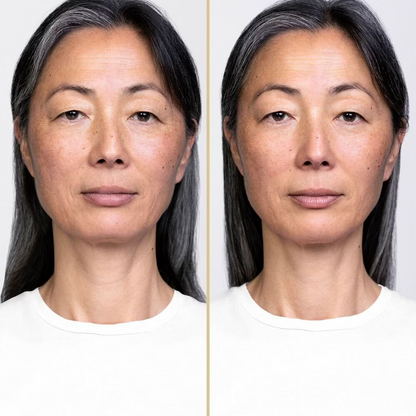 SHISEIDO - VITAL PERFECTION LIFTDEFINE RADIANCE NIGHT CONCENTRATE