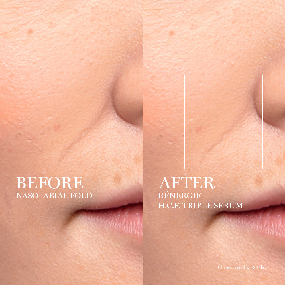 LANCÔME - RÉNERGIE H.C.F. TRIPLE SERUM