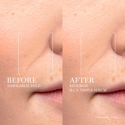 LANCÔME - RÉNERGIE H.C.F. TRIPLE SERUM